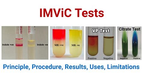 imvic results|salmonella imvic results.